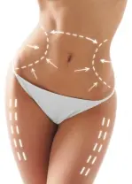 Kryolipolyse München - Schönheitsklinik Dr. FUNK